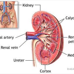 Uric Acid Crystals In Bladder - Causes Of Gout